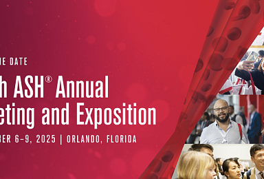 머크, 'LSD1 저해제' PV 2상 효능 애매..“추가개발 보류”