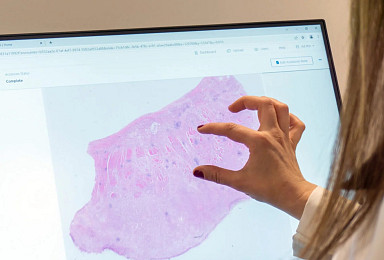 패스AI, MASH ‘병기진단 AI’ 임상시험 사용 “FDA 인증”