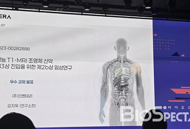 인벤테라, ”해상도 10배·독성없는 조영제 상업화 도전”