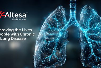 알테사, 시리즈B 7500만弗..'COPD 항바이러스제' 개발