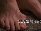EBS '명의' 정홍근 교수가 전하는 발목관절염ㆍ발목 불안정증(인대파열)ㆍ무지외반증 등 발 질환 및 치료법