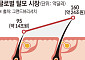 1000만 탈모인, ‘게임체인저’ 기다린다[자라나라 머리머리]