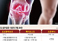 미충족 수요 큰 ‘골관절염’…해외에서 잘 나가는 국산 신약들[K-제약 글로벌 확장②]