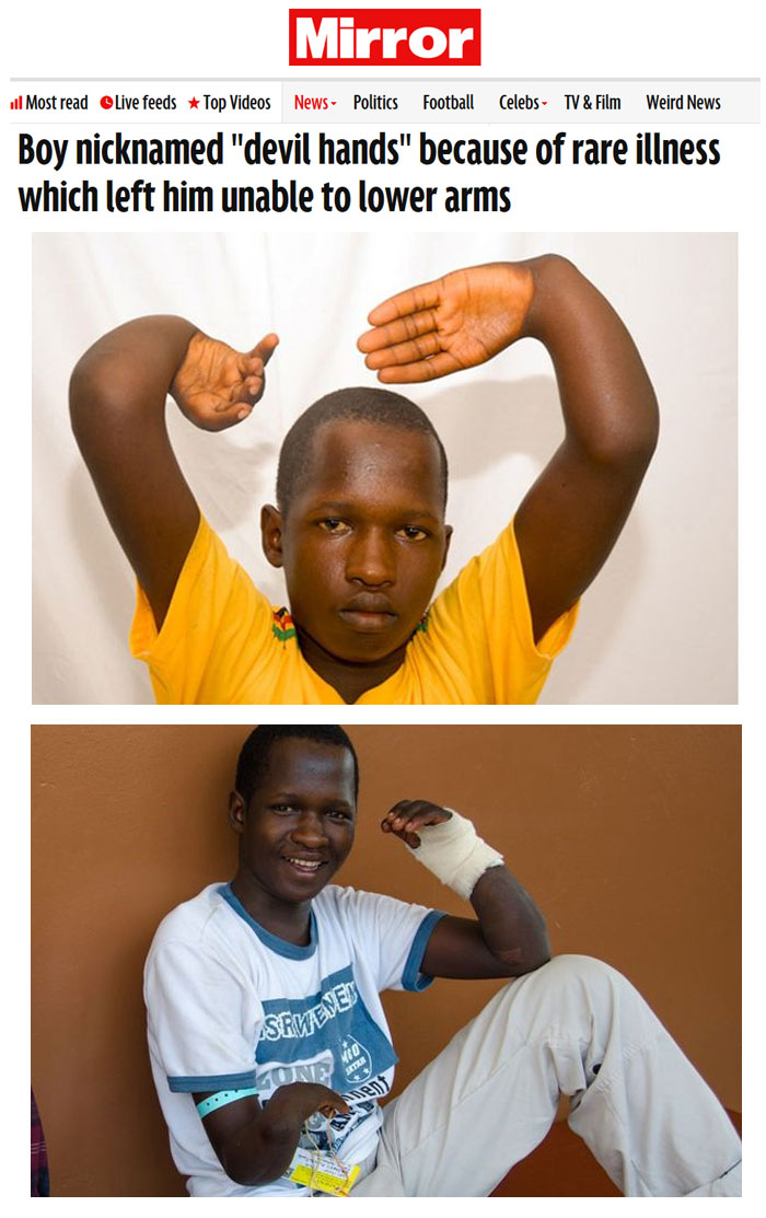 [포토] 양팔이 뒤틀린 '악마의 손' 소년… 수호천사를 만나다