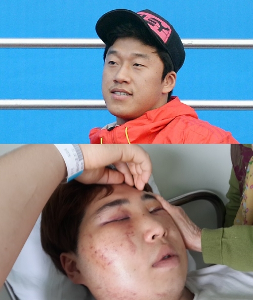 ▲사재혁 선수(위), 폭행 당한 후배 화우만 선수(아래) (사진=뉴시스)