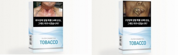 ▲흡연 경고그림 시안 중 (왼쪽) 후두암 환자의 사진 (오른쪽) 구강암 환자의 사진.(표=보건복지부 )
