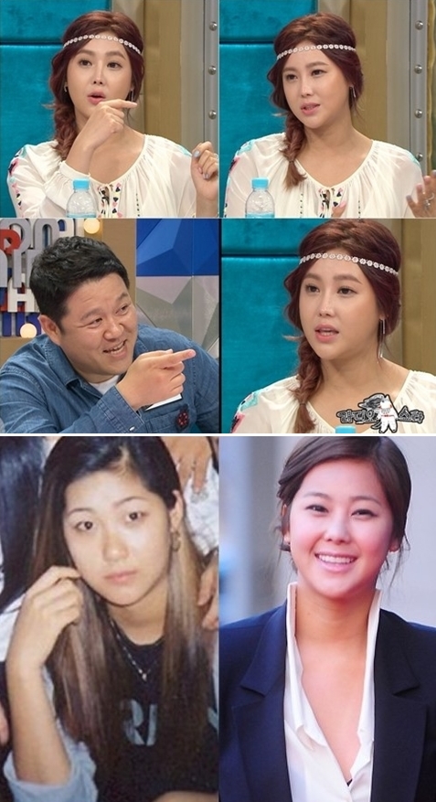 가수 솔비 성형 전후 모습에 관심…라디오스타 김구라 "옛날 얼굴이 더 좋았다"