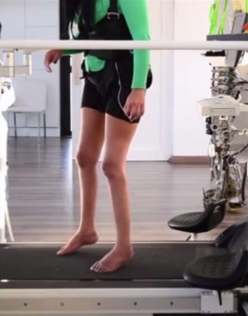 ▲과학자들이 로봇과 가상현실을 활용해 척수마비 치료에 새 돌파구를 마련했다고 11일(현지시간) 영국 파이낸셜타임스(FT)가 전했다. 사진은 13년간 마비 상태에 있다가 다리를 움직일 수 있게 된 한 여성. 출처 알베르토 산토스뒤몽협회 신경재활연구소(AASDAP) 유튜브 페이지.  