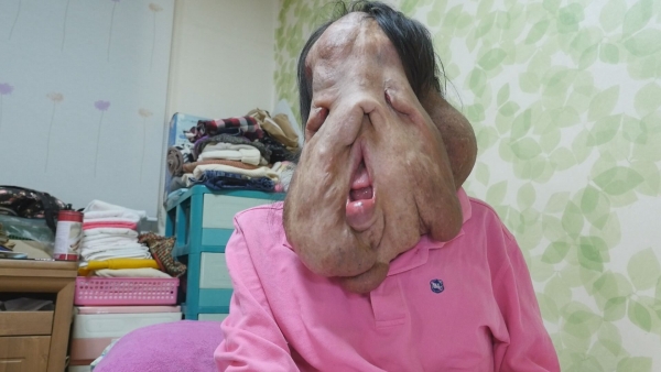 ▲SBS '세상에이런일이'에 출연한 심현희 씨의 모습(사진=SBS)