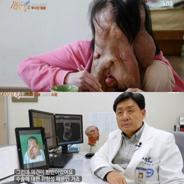 ▲'세상에이런일이' 신경섬유종 환자 (출처=SBS '세상에 이런일이' 영상 캡처)