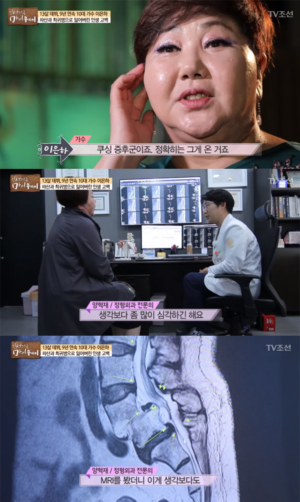 ▲'인생다큐 마이웨이' 이은하(사진=TV조선)