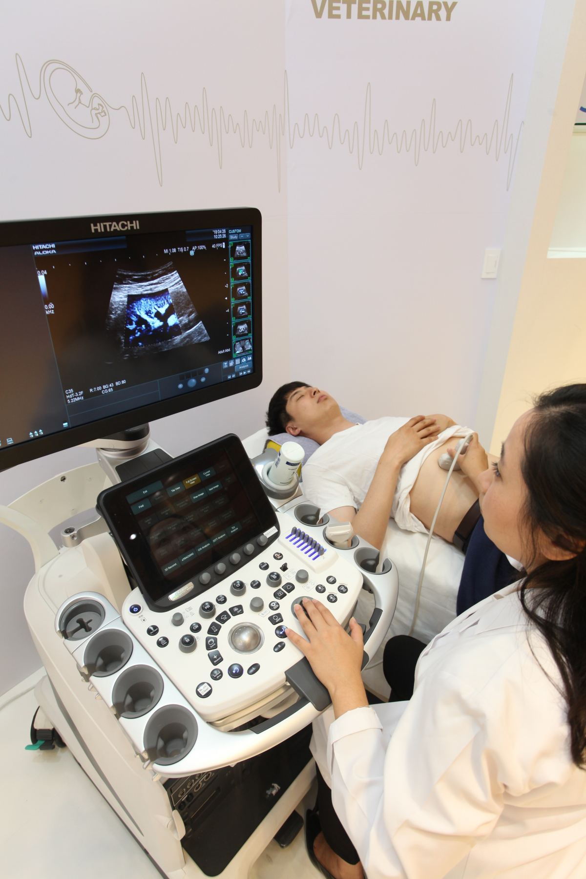 ▲JW메디칼이 8일 서울 강남구 코엑스에서 열린 ‘K-Hospital Fair 2018’ 전시회에 참가해 종양의 악성 여부를 손쉽게 판단할 수 있는 프리미엄 초음파 영상진단장치 ‘알로카 아리에타 850(ALOKA ARIETTA 850)’을 선보이고 있다.(사진제공=JW메디칼)