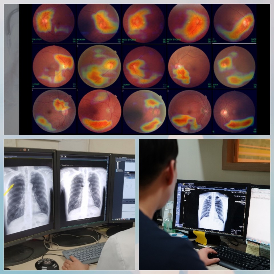 ▲병원 내 의료 인공지능(AI)도입 가속화. (위쪽부터)(주)메디웨일, (주)루닛