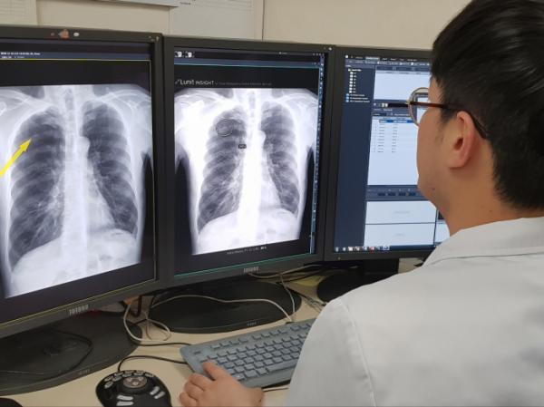 ▲서울대병원이 올해 1월부터, 흉부 엑스선 영상 판독에 인공지능 기술 을 활용한다. (서울대병원)