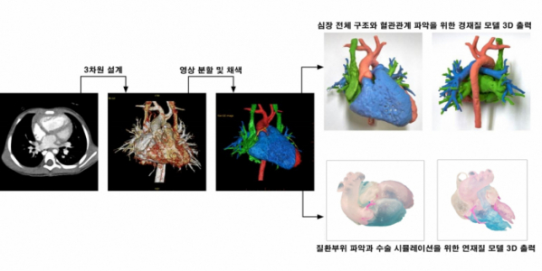 ▲3D프린팅_심장기형질환 수술 시뮬레이션 모형 (아산병원)