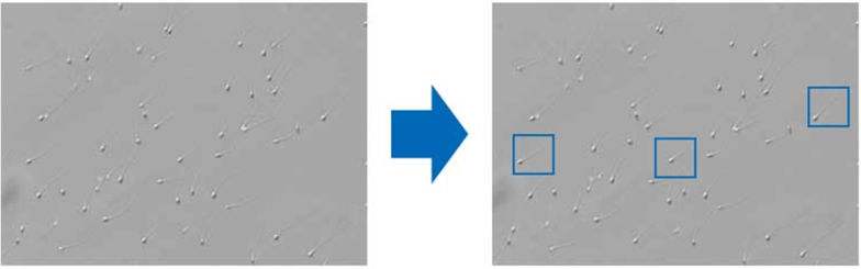 ▲양질한 정자를 인식해 실시간으로 표시해주는 ’정자 선별 보조 AI 시스템’(올림푸스)