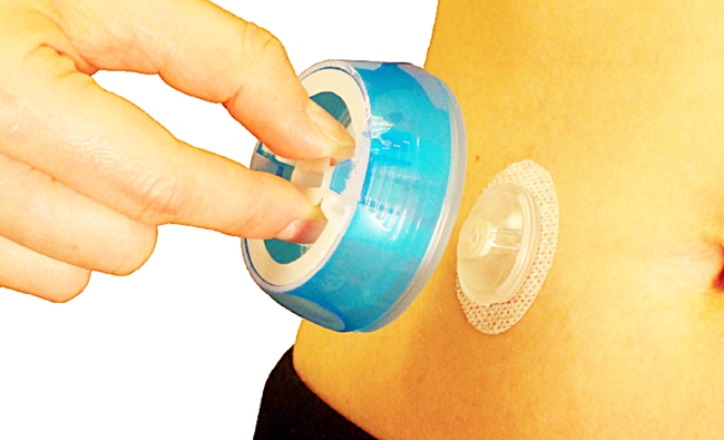 ▲아이포트 어드밴스(메드트로닉코리아)