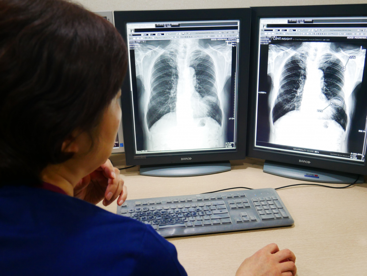 ▲좋은문화병원이 루닛 인사이트 도입(루닛)