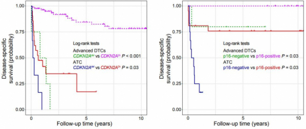▲ CDKN2A 유전자 결실(좌) 및 p16 단백질 발현(우)에 따른 한국인 갑상선암 환자의 생존율 차이. 미분화 갑상선암 환자 및 진행성 분화 갑상선암 환자 모두에서 CDKN2A 유전자의 결실이 있을 때 결실이 없는 환자에 비해 생존율이 크게 감소하는 것을 확인하였다.  (CDKN2A  유전자에 결실이 있는 경우:  위험비 6.67 / p16 단백질의 발현이 떨어지는 경우:  위험비 35.25)(마크로젠)