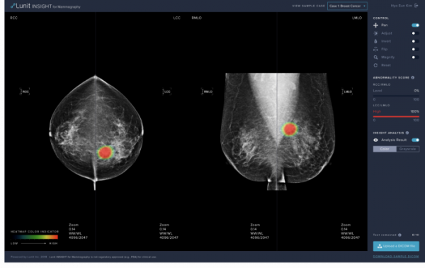 ▲루닛 인사이트 MMG 온라인 데모 웹사이트 화면. 유방암 진단보조 소프트웨어 29일 허가 받았다.(루닛)
