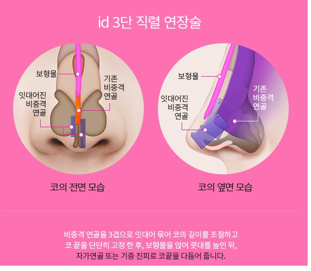 (아이디병원)