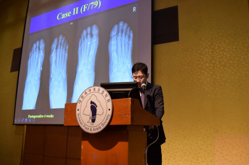 ▲연세건우병원이 대한족부족관절학회 국제학술대회에서 발표를 하고 있다. (연세건우병원)