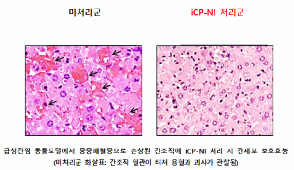 (자료제공=셀리버리)