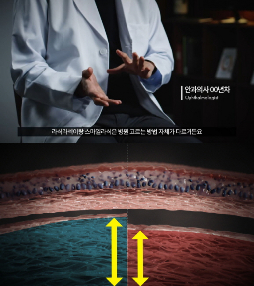 ▲사진=(좌) 경험이 많은 의사, (우) 경험이 부족한 의사. 의료진 숙련도에 따른 잔여 각막량의 차이(영상 출처: The Rights to know the Medical Information 유튜브 채널 - ‘안과의료진 10인의 고백’)