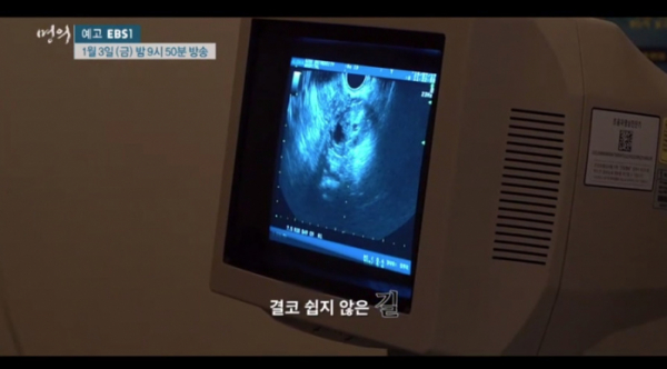 ▲'EBS 명의' 난임(사진제공=EBS)