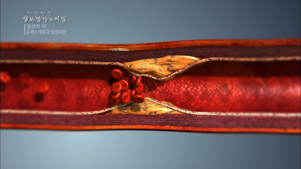 ▲'생로병사의 비밀'(사진제공=KBS 1TV)