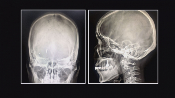▲'순간포착 세상에 이런 일이'(사진제공=SBS)