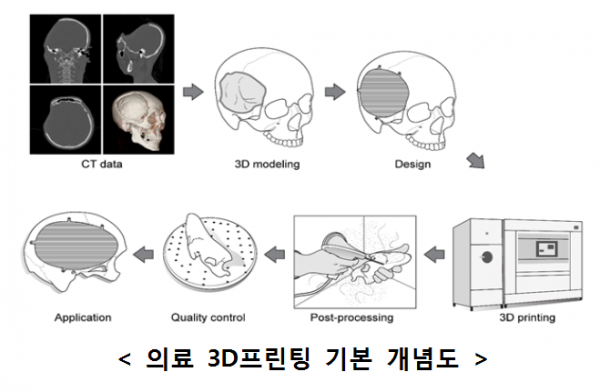 ▲의료 3D프린팅 기본 개념도 (과기정통부 제공)