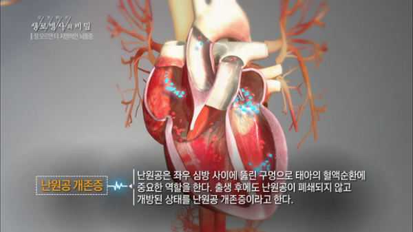 ▲'생로병사의 비밀'(사진제공=KBS 1TV)