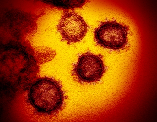 ▲미국 국립보건원(NIH) 산하 국립알레르기전염병연구소(NIAID)가 전자현미경으로 촬영한 코로나19 사진. AP뉴시스
