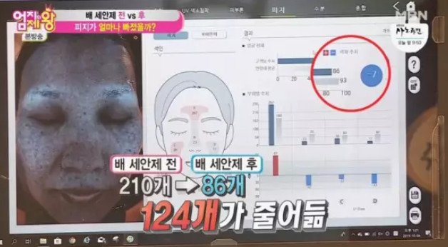 (출처=MBN '엄지의 제왕' )