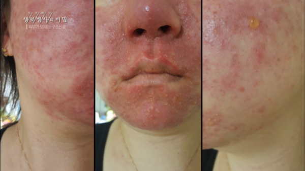 ▲'생로병사의 비밀' (사진제공=KBS 1TV)