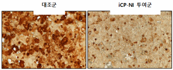 ▲ iCP-NI 투여에 의한 급성간염 동물모델의 간조직 보호효능 (사진제공=셀리버리)