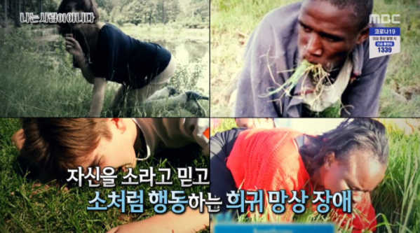 ▲보안드로피 증후군을 '서프라이즈'에서 소개했다.(사진=MBC '서프라이즈' 방송화면 캡처)