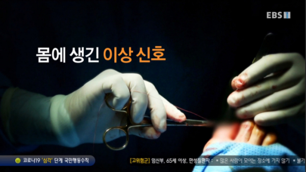 ▲EBS 명의 대상포진, 흑색종, 통풍   (사진제공=EBS)