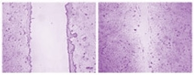 ▲Autophage(자식작용)의 결핍이 세포의 암화 및 전이를 유도하는 모습
(왼쪽)전이가 안 된 정상세포(오른쪽) 자식작용 단백질에 이상이 생겨 전이가 된 세포
 (하엘)