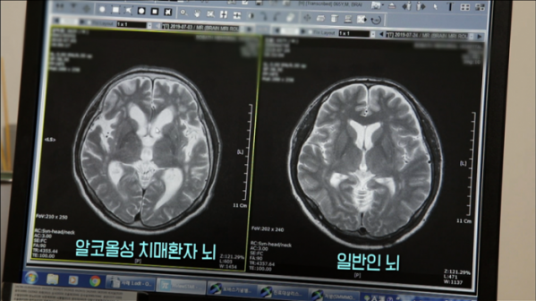 ▲'생로병사의 비밀'(사진제공=KBS 1TV)