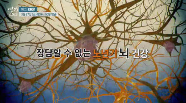 ▲'EBS 명의 스페셜' 치매와 파킨슨병(사진제공=EBS)