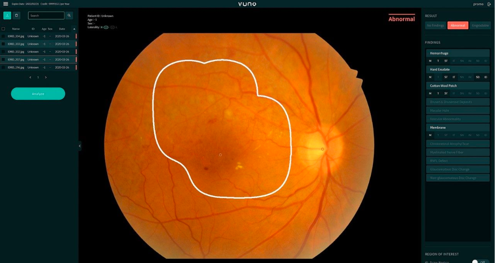 ▲뷰노메드 펀더스 AI 제품 (사진제공=엔비디아)