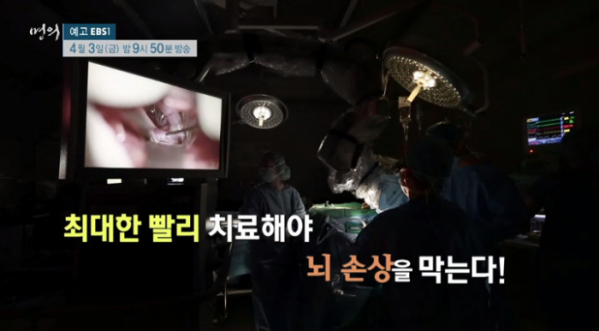 ▲'EBS 명의 스페셜' 뇌졸중(사진제공=EBS)