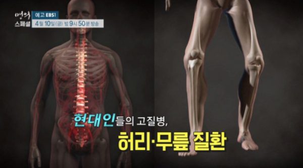 ▲'EBS1 명의' 무릎, 척추 통증(사진제공=EBS)