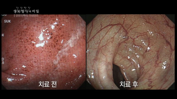 ▲'생로병사의 비밀'(사진제공=KBS 1TV)