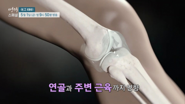 ▲EBS 명의 스페셜 '당신이 꼭 알아야 할 무릎 통증'(사진제공=EBS1)
