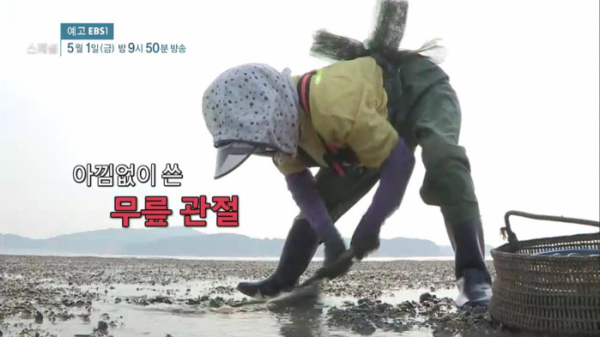 ▲EBS 명의 스페셜 '당신이 꼭 알아야 할 무릎 통증'(사진제공=EBS1)