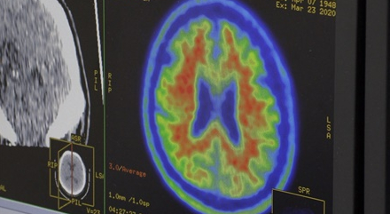 ▲'다큐 인사이트'(사진제공=KBS 1TV)