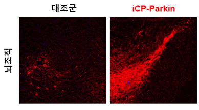 ▲iCP-Parkin의 도파민 신경세포(붉은색) 회복 효능 (자료제공=셀리버리)